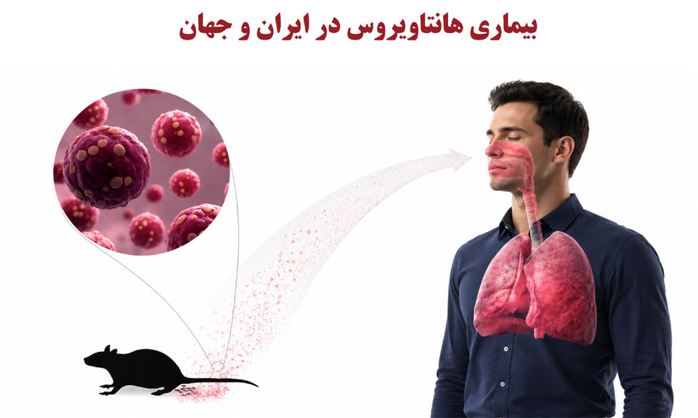 آشنایی با بیماری‌های قابل انتقال بین انسان و حیوان - (هانتاویروس)